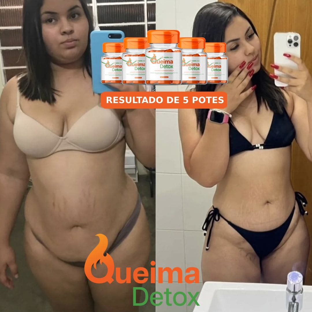 Resultado Antes e Depois 2