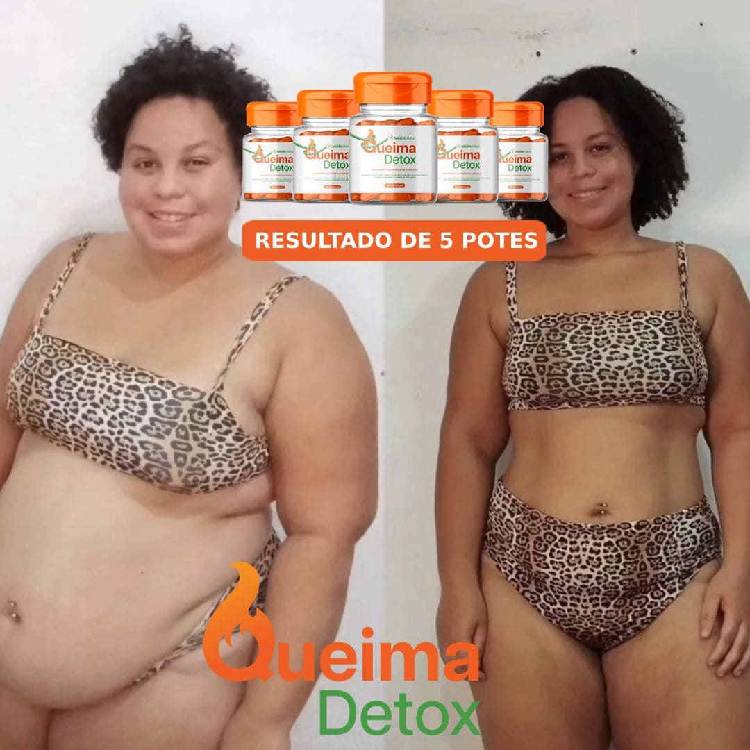 Resultado Antes e Depois 4